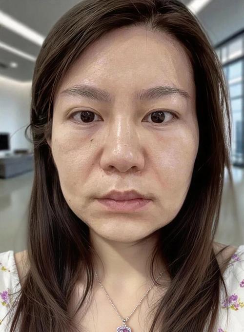 扎头发会导致脸部皮肤松弛吗_扎头紧伤头皮发际线？别太用力！