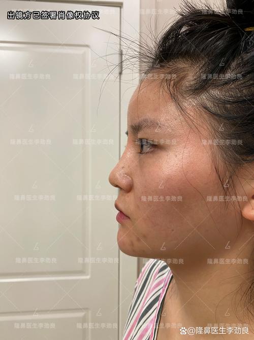 做了鼻子多久能化妆_隆鼻后多久能化妆?恢复期化妆指南 做了鼻子多久能化妆_隆鼻后多久能化妆?恢复期化妆指南