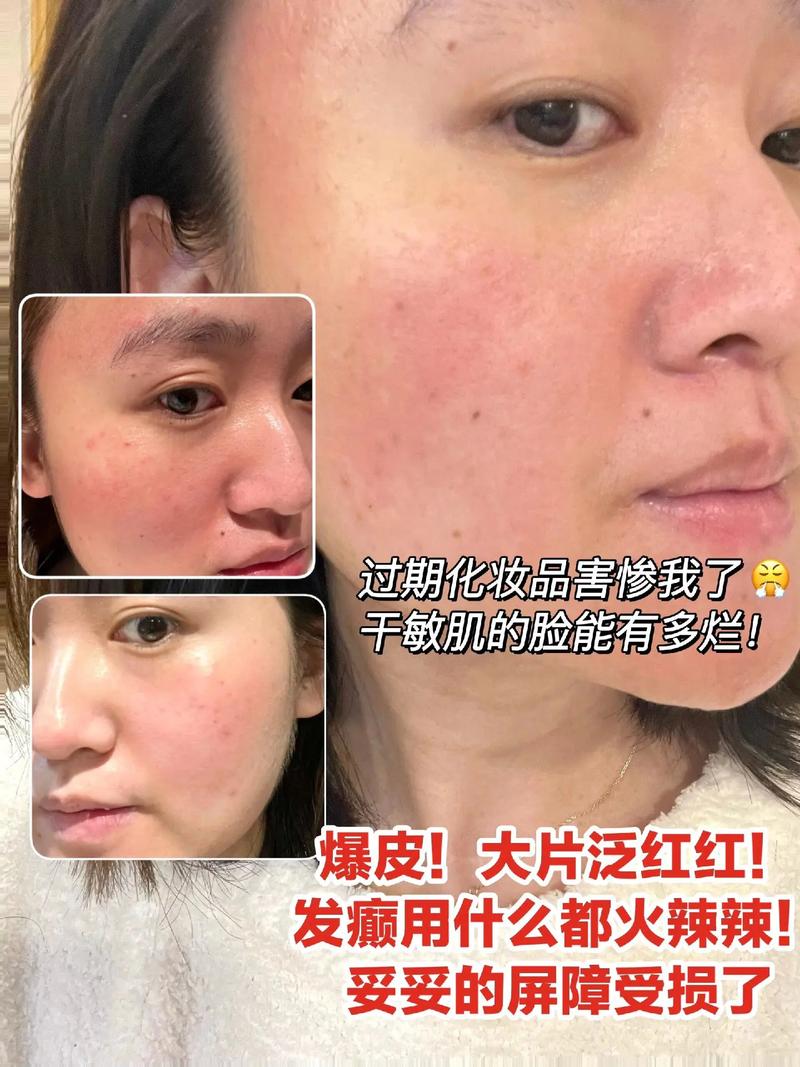 长期使用化妆品危害_化妆品伤皮肤?选对用对保健康! 长期使用化妆品危害_化妆品伤皮肤?选对用对保健康!