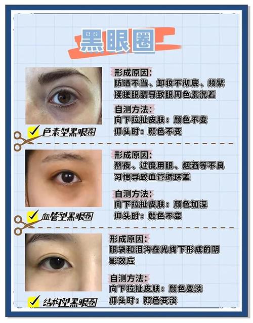 去黑眼圈眼袋小妙招_冷敷眼霜睡好,缓解浮肿黑眼圈 去黑眼圈眼袋小妙招_冷敷眼霜睡好,缓解浮肿黑眼圈