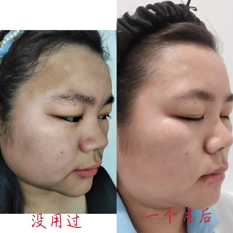 长期不化妆皮肤会变差吗_不化妆皮肤更健康？做好基础保养很重要！