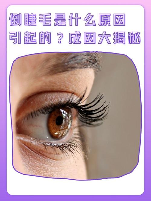 8岁女孩掉睫毛是什么原因_女孩睫毛掉多？别慌，看这几种原因！