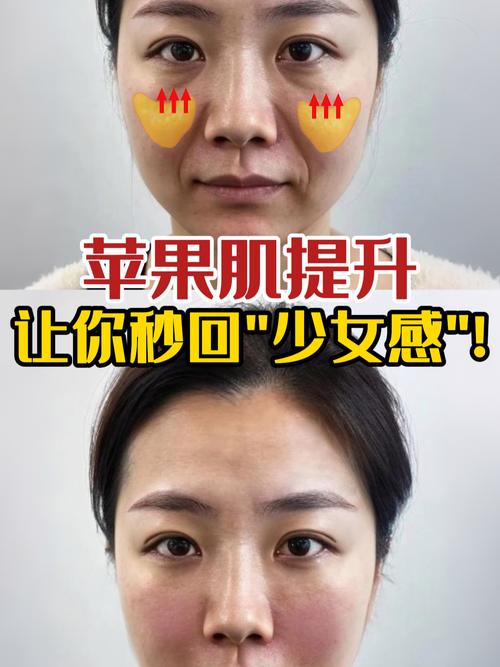 苹果肌下垂提升的最好方法_按摩护肤医美科技健康生活皆有效