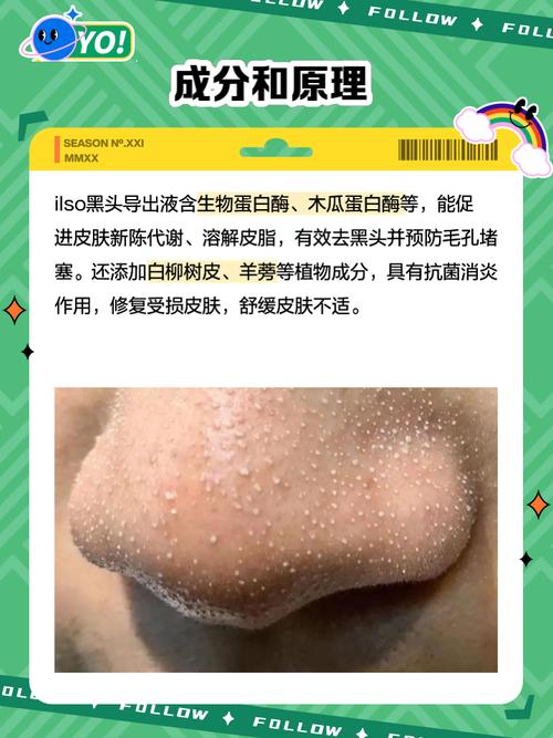 黑头导出液的正确使用方法_水杨酸黑头导出液怎么用?温和清洁防刺激 黑头导出液的正确使用方法_水杨酸黑头导出液怎么用?温和清洁防刺激