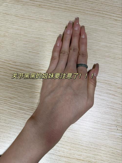 去关节黑最有效的方法_关节黑斑多因污垢堆积导致,需温和清洁并轻柔去角质 去关节黑最有效的方法_关节黑斑多因污垢堆积导致,需温和清洁并轻柔去角质