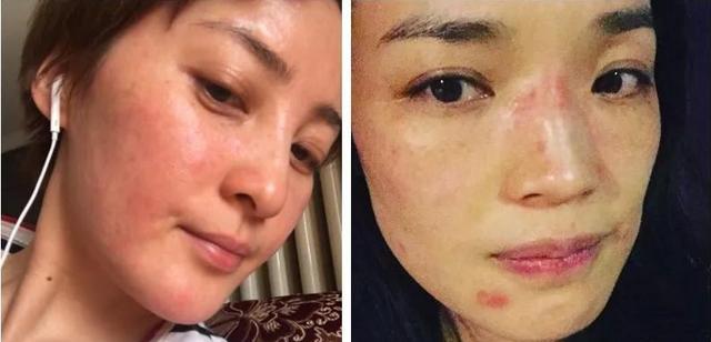 频繁化妆的人皮肤不好吗_慎用化妆品，呵护健康肌肤