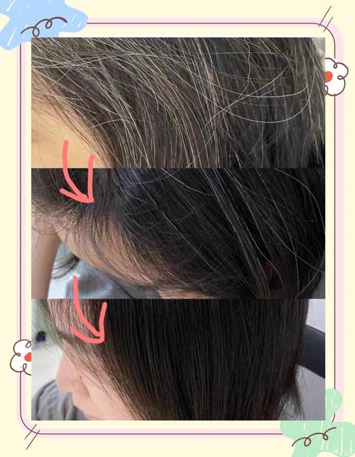 八九十岁老人头发会变黑吗_白发变黑原因多，营养心情是关键！