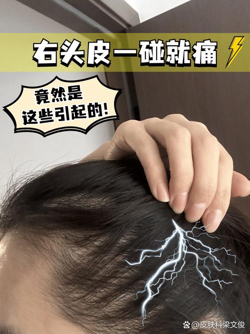 一碰头发头皮就像针扎一样疼_头皮一碰就疼?快查查原因! 一碰头发头皮就像针扎一样疼_头皮一碰就疼?快查查原因!