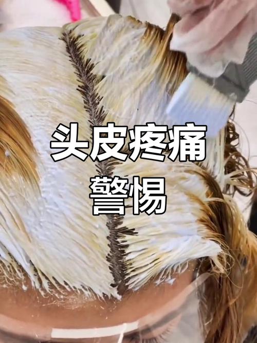 漂完头发后一摁头皮很疼正常吗_漂发头皮痛怎么办? 漂完头发后一摁头皮很疼正常吗_漂发头皮痛怎么办?