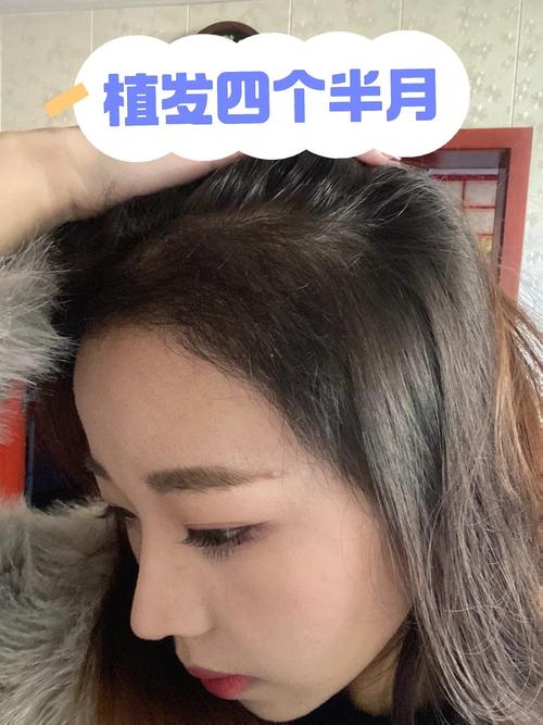 四个月头发能留多长_头发每月长1-2厘米？这样促生长！