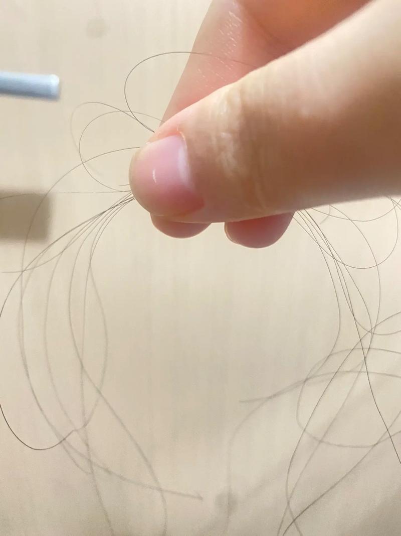 一抓头发掉好几根头发_掉发多?查查原因,健康生活防脱发 一抓头发掉好几根头发_掉发多?查查原因,健康生活防脱发