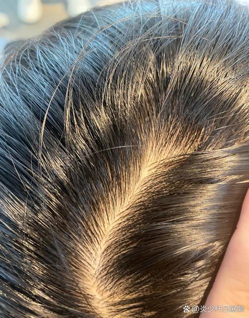 凉水洗头发但不粘头皮_凉水洗头，清爽控油，头皮更健康！