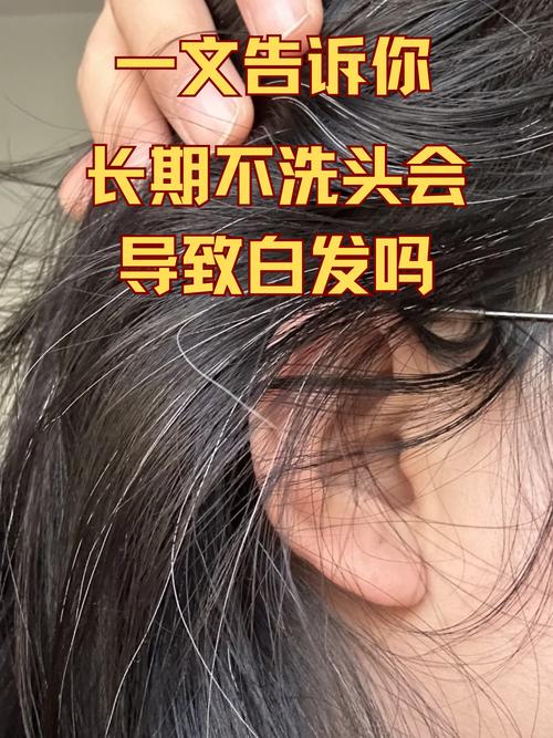 用护发精油长白头发更快吗_护发精油养发不致白，少量涂抹防油腻
