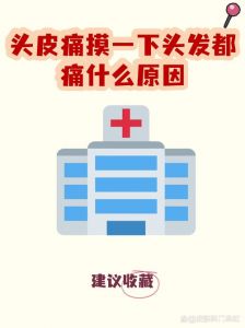 碰到头发头皮就疼咋回事_头皮一碰就疼？可能是这几种原因！