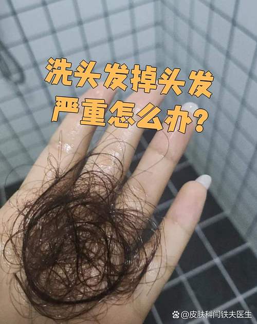 刚扯掉一两根头发能洗头吗_洗头前看头皮伤,轻柔洗护防感染 刚扯掉一两根头发能洗头吗_洗头前看头皮伤,轻柔洗护防感染