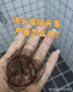 刚扯掉一两根头发能洗头吗_洗头前看头皮伤，轻柔洗护防感染
