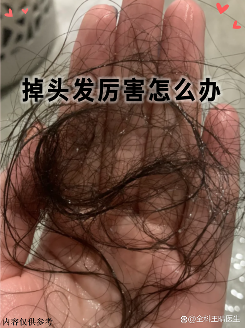 被人使劲拽头发会脱发吗_扯头发伤毛囊会脱发,轻柔护理是关键 被人使劲拽头发会脱发吗_扯头发伤毛囊会脱发,轻柔护理是关键