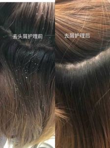 煤焦油和二氧化硒哪个洗头发好_敏感头皮选温和煤焦油，重脂溢选强效二氧化硒