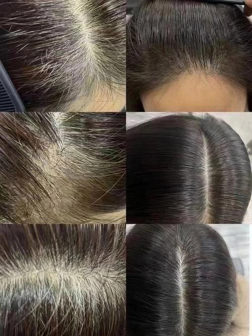 人老了头发为什么会变白_遗传衰老伤身,饮食减压护头皮 人老了头发为什么会变白_遗传衰老伤身,饮食减压护头皮