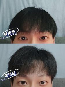 发泥不洗掉会伤头发吗_发泥残留伤头皮，用对才护发