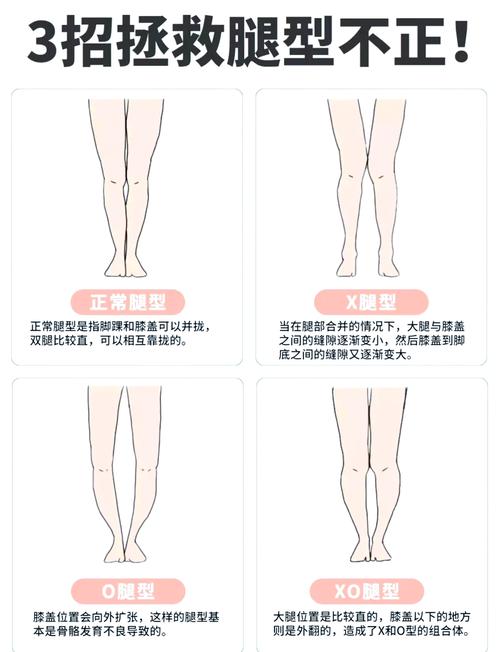 x型腿是练大腿内侧还是外侧_X型腿？练对肌肉，体态行动好回来