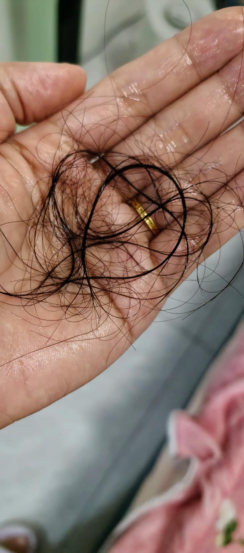 染头发掉发快还是烫头发掉发快_烫染伤毛囊致脱发？选对护理能缓解