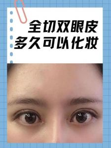 割眼袋后多久可以化妆_1周内禁碰化妆，用修复品冰敷