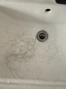 熬夜掉头发还能长回来吗_熬夜掉发休止期脱发怎么办？