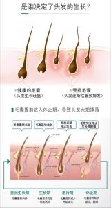 天冷了头发是不是长的慢_天冷脱发？头发生长与季节有关