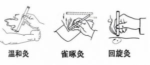 炙的方法有几种_中医古法，治病保健好选择