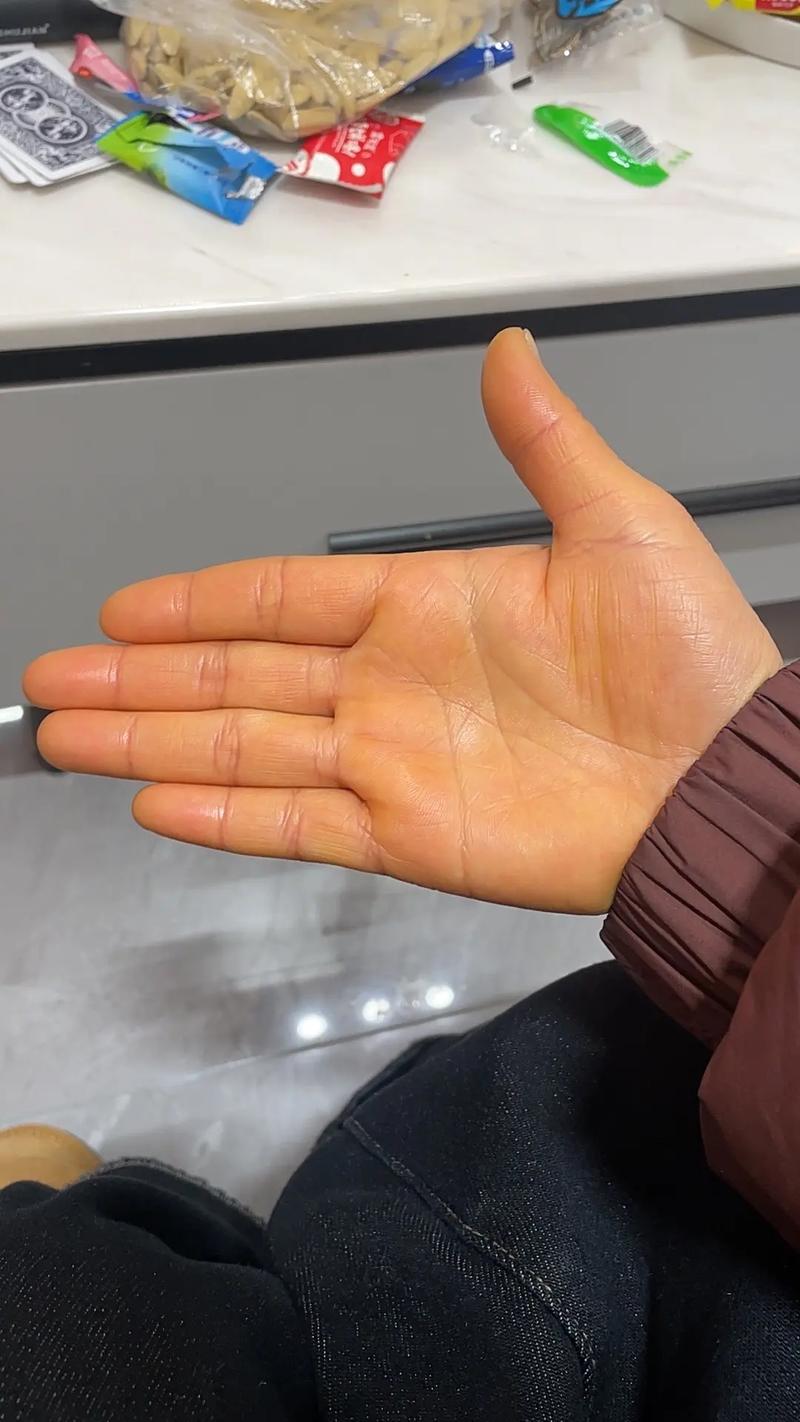 手掌泛黄是什么原因_手掌发黄?食物疾病都可能导致 手掌泛黄是什么原因_手掌发黄?食物疾病都可能导致
