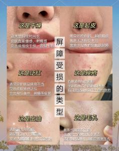 把化妆品打到皮肤里怎么办_化妆品灼伤别慌，清水冲洗冷敷，注意过敏！