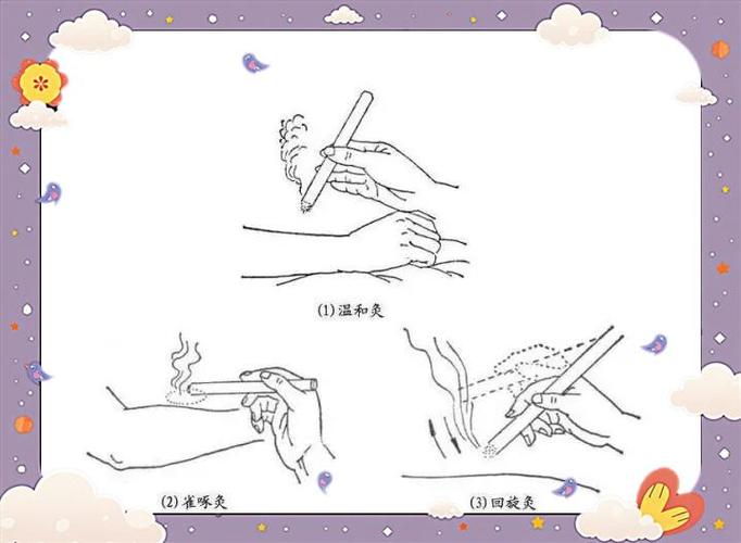 艾条灸详细操作步骤_温和雀啄回旋隔物瘢痕灸