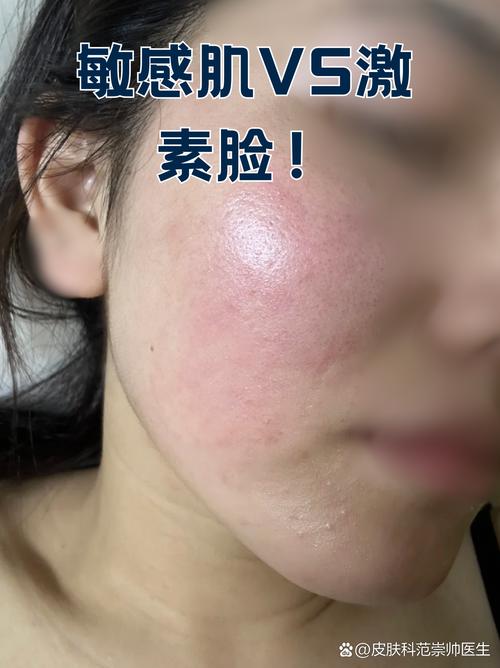 激素化妆品停用后_停用激素化妆品后如何修复皮肤屏障？