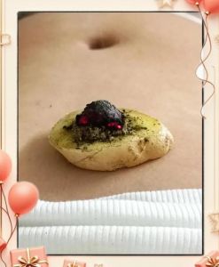 隔姜灸的基本操作步骤是什么_姜片与艾炷的讲究