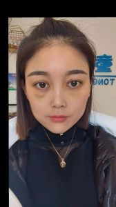 做眼袋好几天不能化妆_眼袋术后一周内勿化妆，待伤口闭合再轻妆