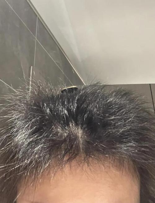 19岁掉头发是肾虚吗_肾虚脱发怎么办？19岁掉发或有关，调整生活有助改善