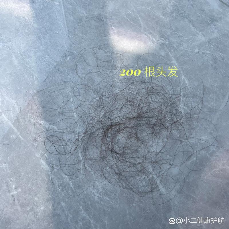 洗一次头发掉多少正常_洗头掉发正常?如何减少掉发? 洗一次头发掉多少正常_洗头掉发正常?如何减少掉发?