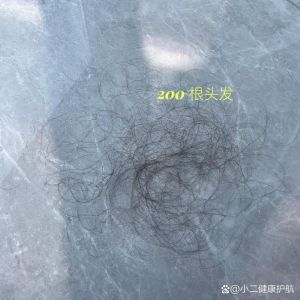 洗一次头发掉多少正常_洗头掉发正常？如何减少掉发？