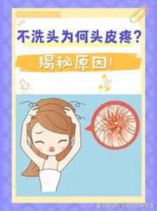 很久没洗头发头皮很痛_头痒痛？勤洗头，选温和洗发水！
