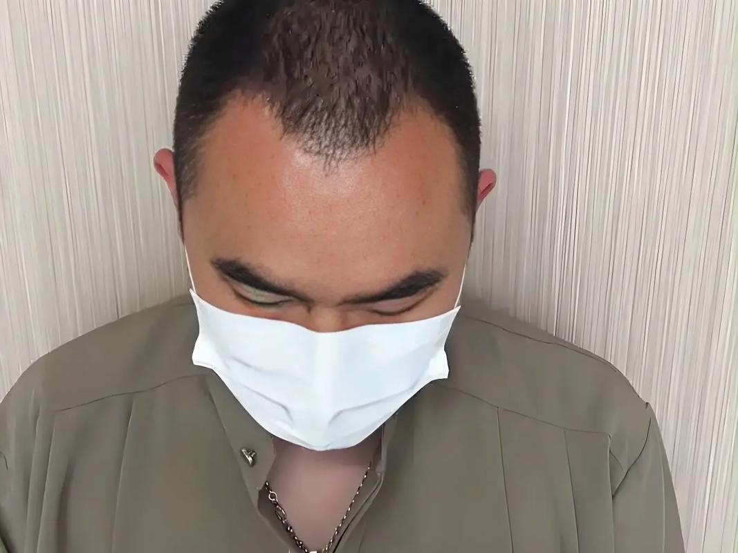 突脑门m型发型脸的轮廓凹凸_M型额头显高?发型这样修,脸小一圈! 突脑门m型发型脸的轮廓凹凸_M型额头显高?发型这样修,脸小一圈!