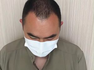 突脑门m型发型脸的轮廓凹凸_M型额头显高？发型这样修，脸小一圈！