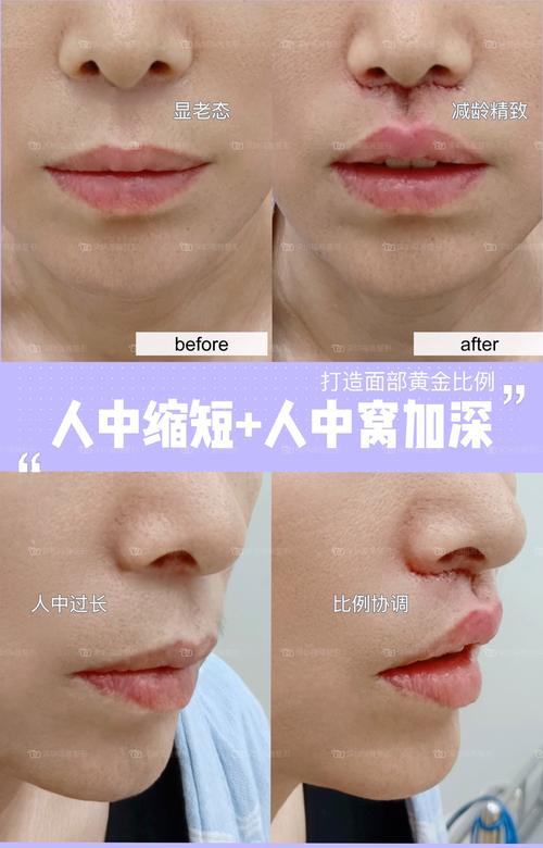 人中化妆时候怎么缩短人中_巧用光影调唇形 人中化妆时候怎么缩短人中_巧用光影调唇形