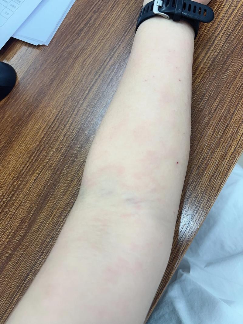 过敏能锻炼吗_春季过敏？室内温和运动，户外选对时机！