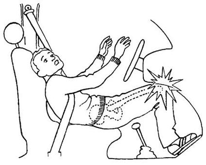 髋骨撞击最怕三个动作_髋伤注意！避免深蹲久坐，选温和运动