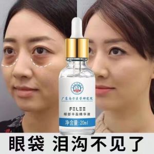 上眼窝凹陷的化妆品_抗皱面霜怎么选？成分肤质要考虑！