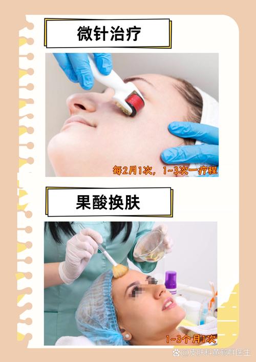 优珈儿的祛斑产品使用步骤_优珈儿祛斑，清洁护理加防晒