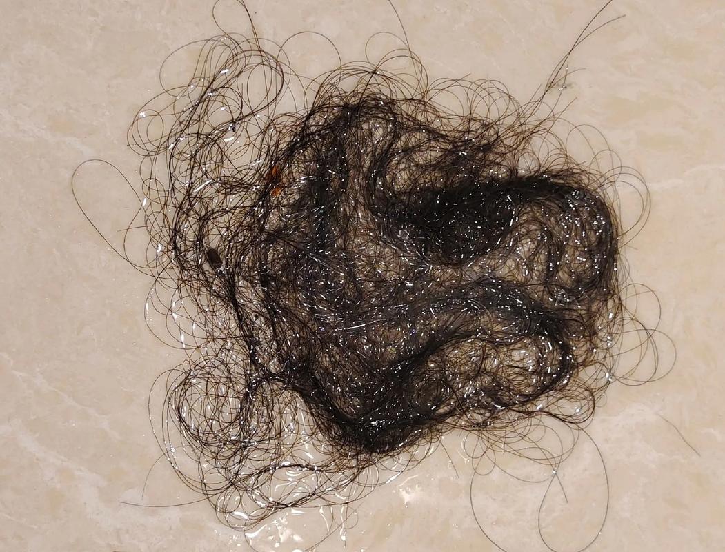 4天洗头发掉200根是脱发吗_正常脱发别担心，洗头掉发多调整就好