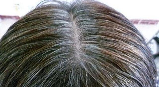 金头发会变成白头发吗_白发增多不用愁，营养均衡压力大减！