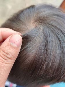 长了一根白头发_遗传饮食压力日晒